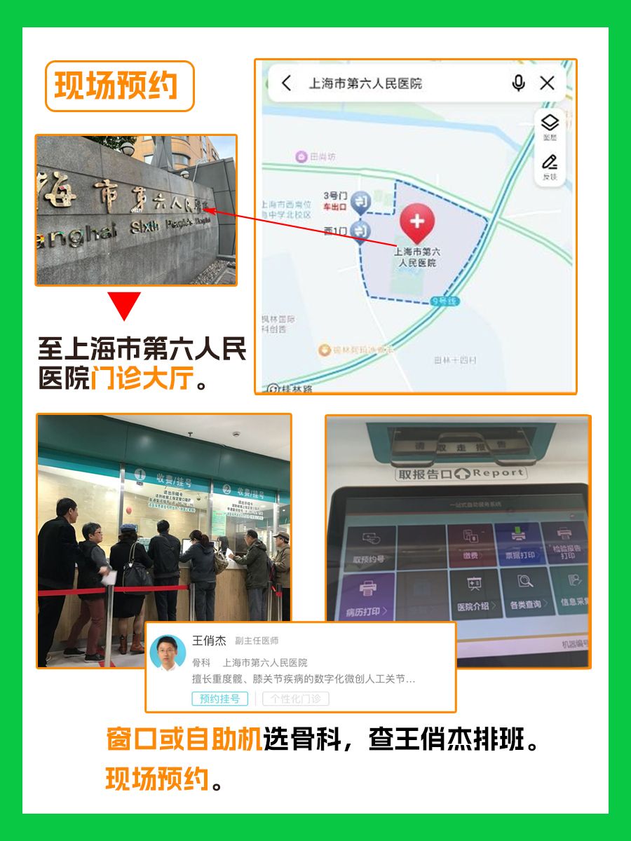 上海市第六人民医院王俏杰医生怎么样？怎么挂号？
