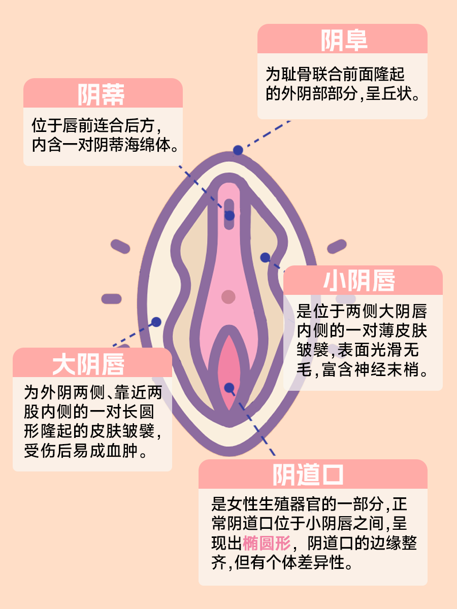 专家带你了解，正常阴道口什么样