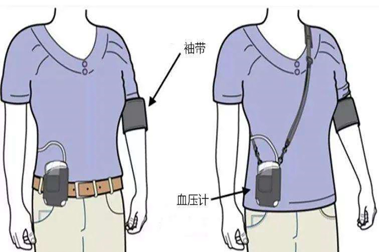 24小时血压动态监测佩戴图