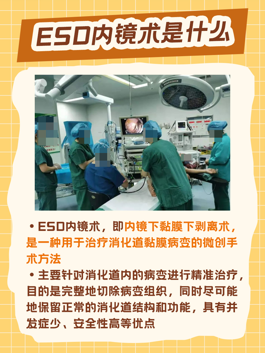 ESD内镜术是什么手术？一文了解！