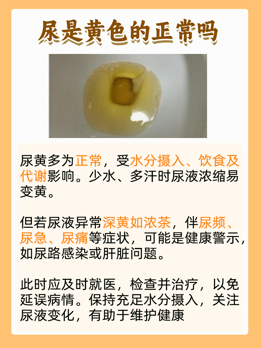 揭秘尿液颜色：黄色尿是否正常？