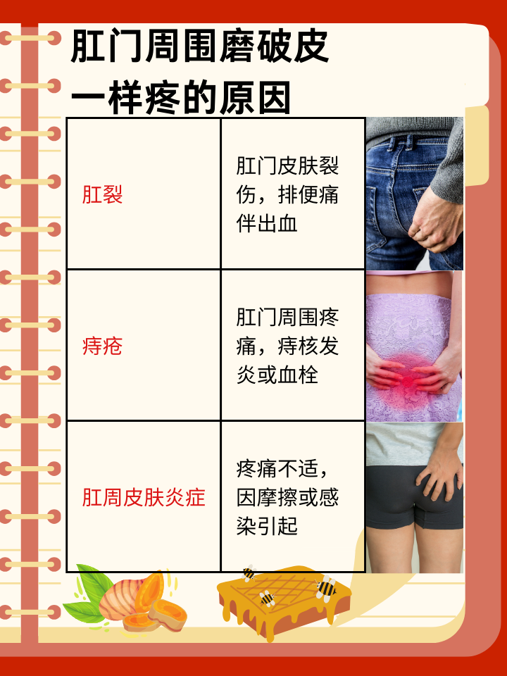 肛门周围疼痛如磨破皮：症状解析