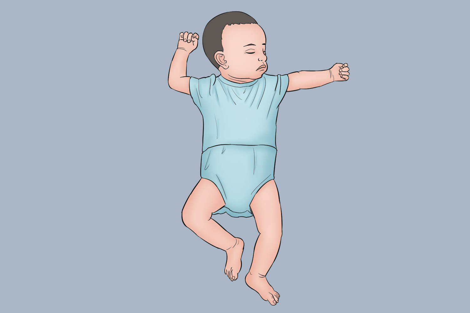 颈肢反射图 颈肢反射图