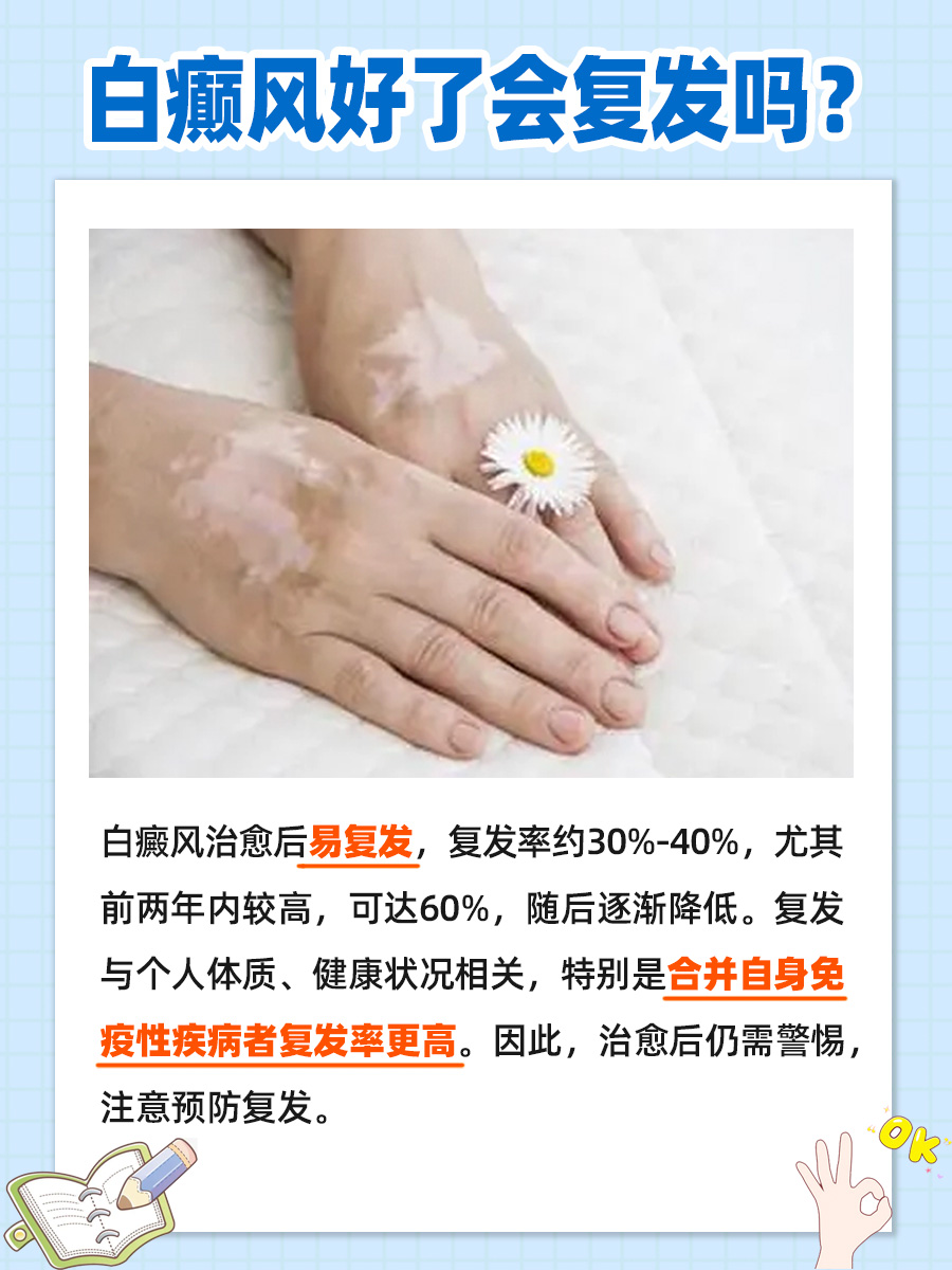 白癫风好了会复发吗？一文解析
