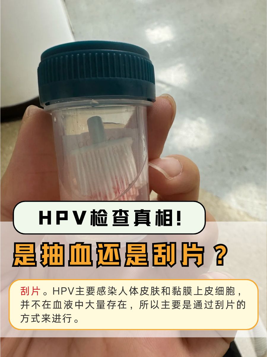 HPV检查真相！是抽血还是刮片？