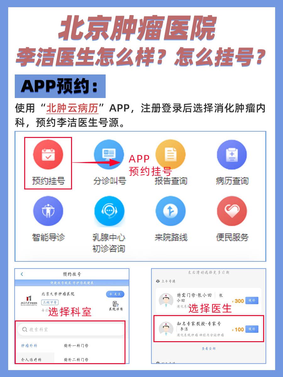 北京肿瘤医院李洁医生怎么样？怎么挂号？