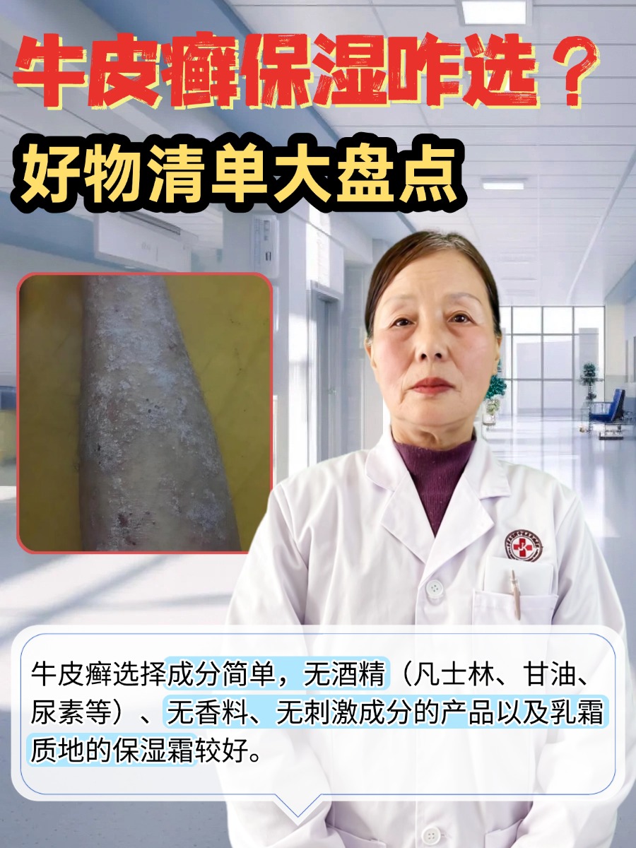 牛皮癣保湿咋选？好物清单大盘点