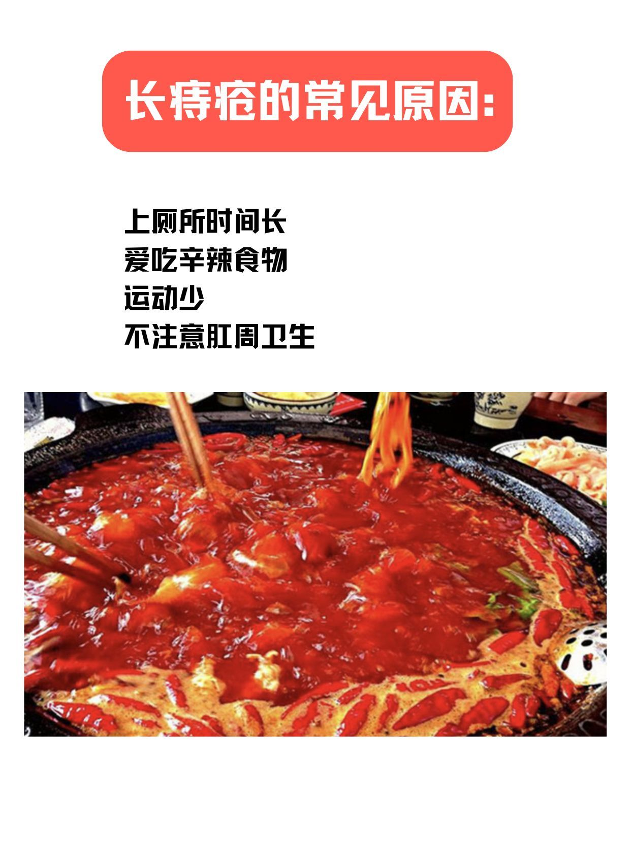 痔疮等级自测｜你的痔疮在哪一级？