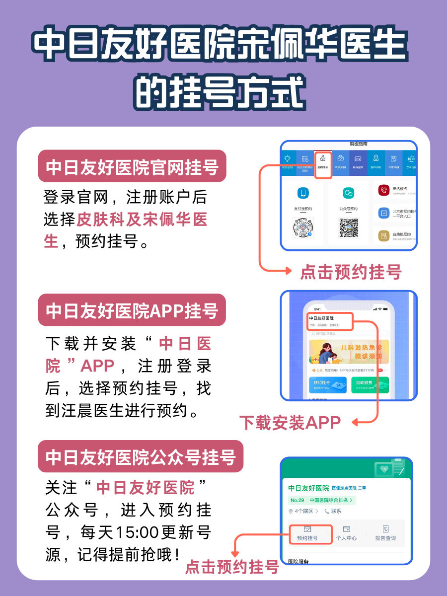 中日友好医院宋佩华医生怎么样？怎么挂号？