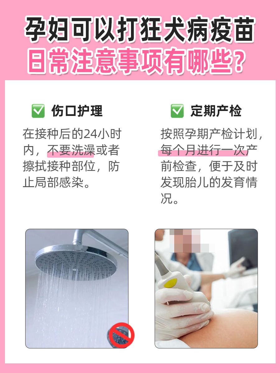 医生带你了解，孕妇可以打狂犬病疫苗吗