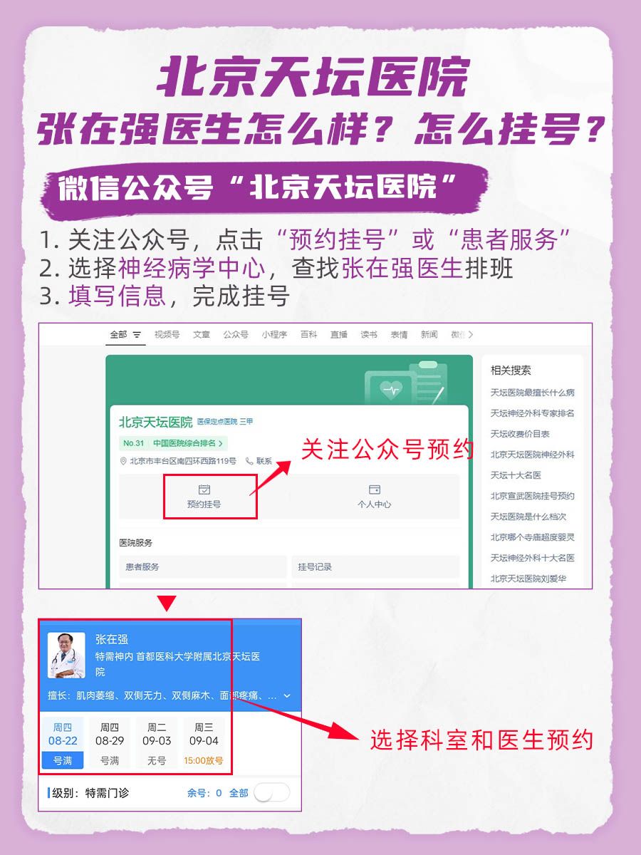 北京天坛医院张在强医生怎么样?怎么挂号?