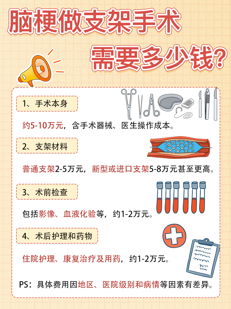 脑梗做支架手术需要多少钱?一文解答