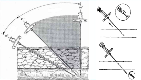 穿刺角度图