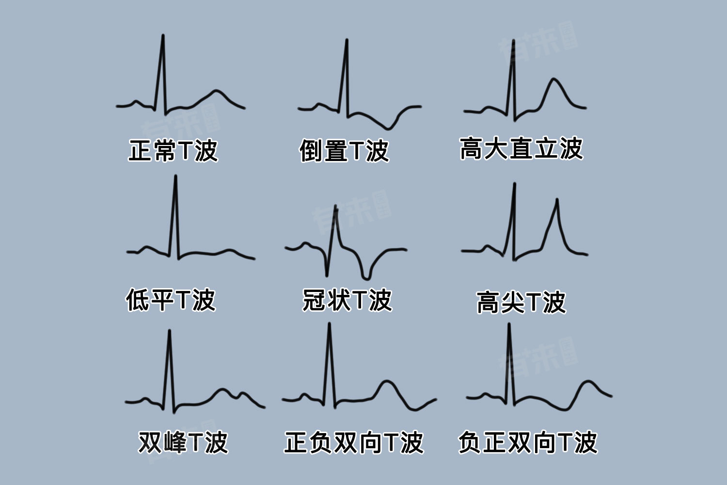 心电图t波低平代表什么