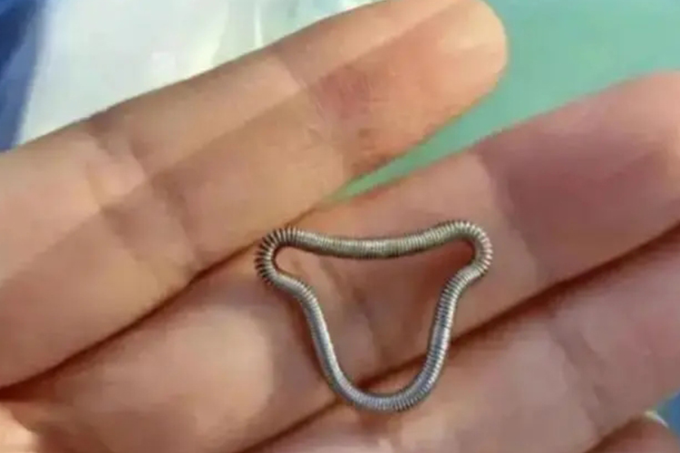 元宫型含铜宫内节育器图