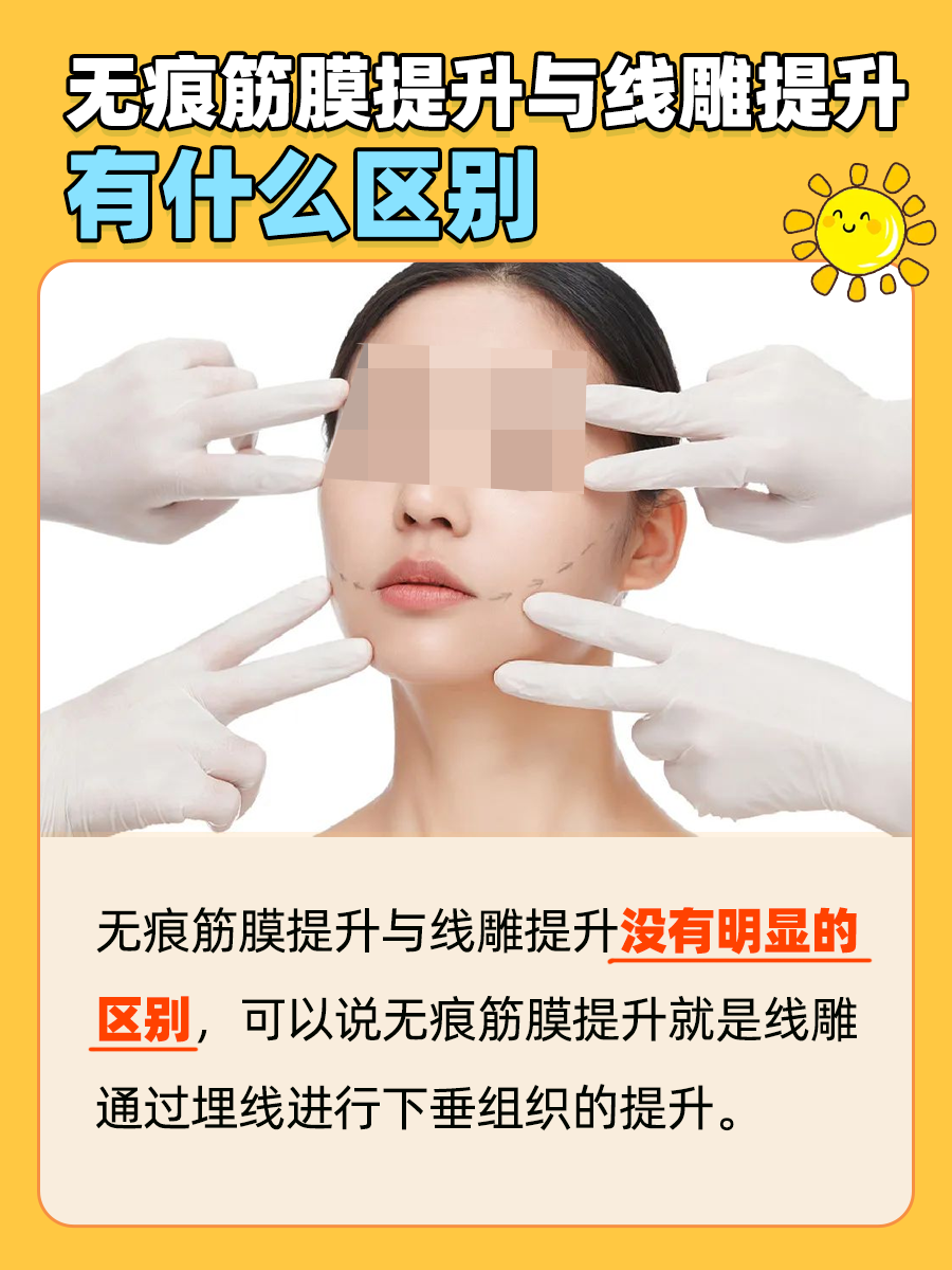 医生告诉你:无痕筋膜提升与线雕提升一样吗 ?