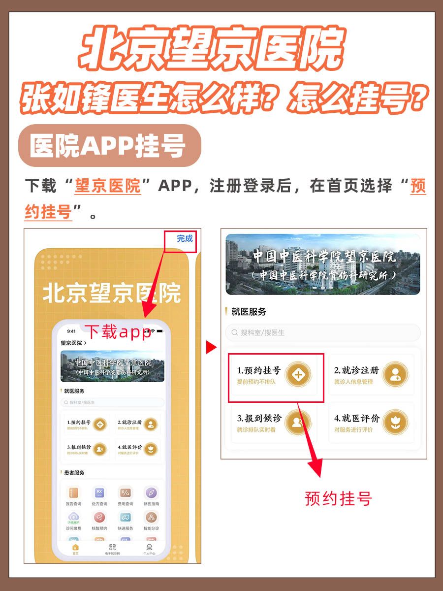 北京望京医院张如锋医生怎么样?怎么挂号?