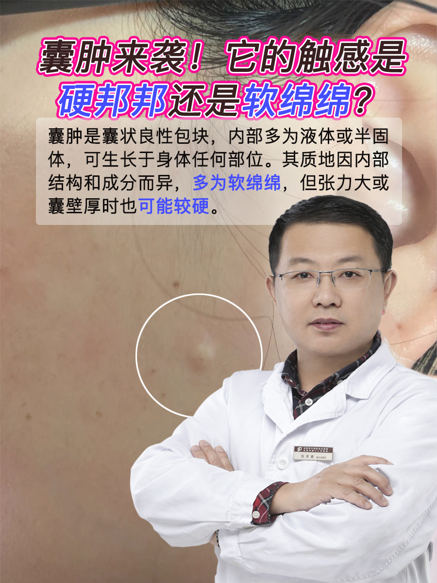 囊肿来袭!它的触感是硬邦邦还是软绵绵?