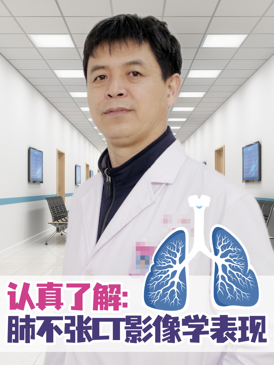 认真了解：肺不张CT影像学表现