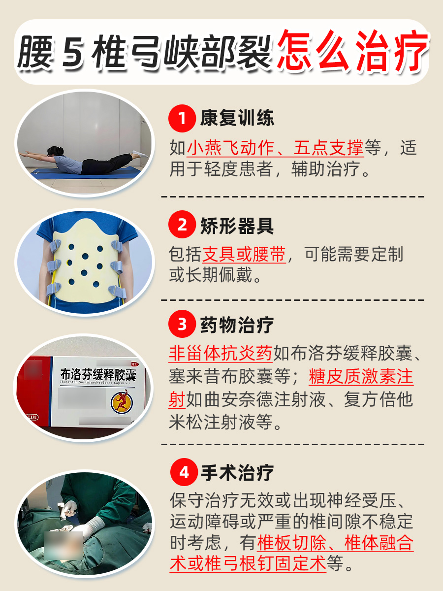 拯救腰5椎弓峡部裂，这些招儿超管用！