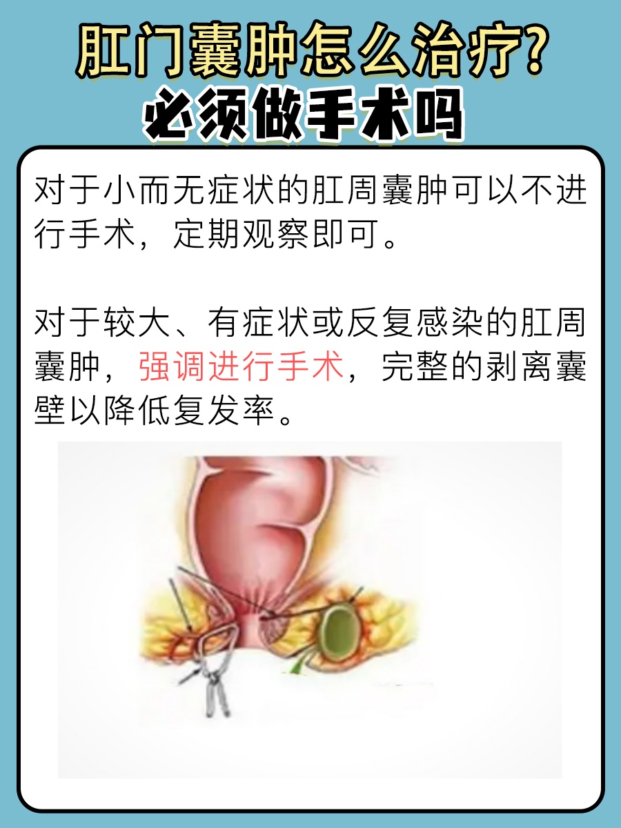 肛门囊肿治疗，是否必须手术？