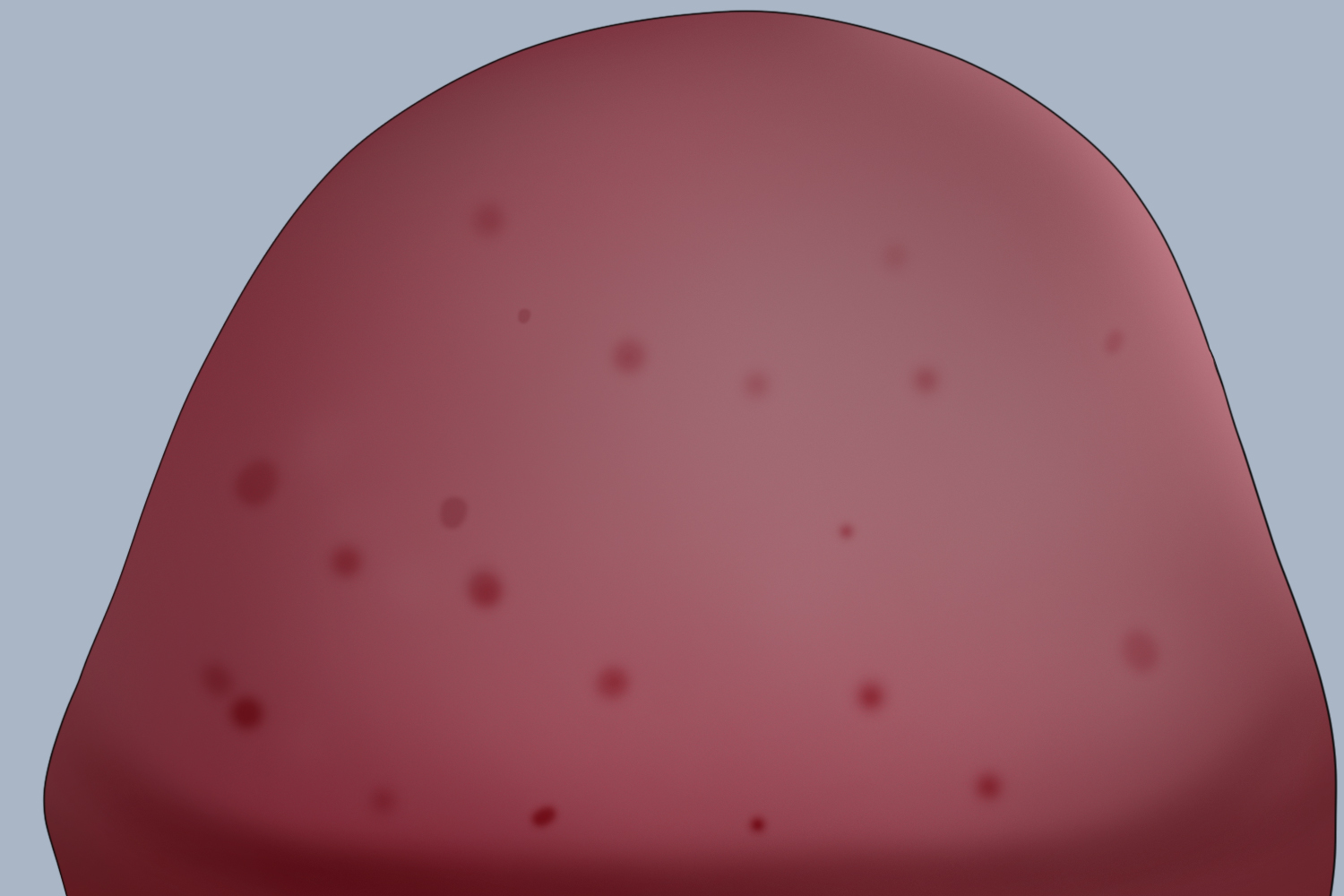 白色念珠菌性包皮龟头炎