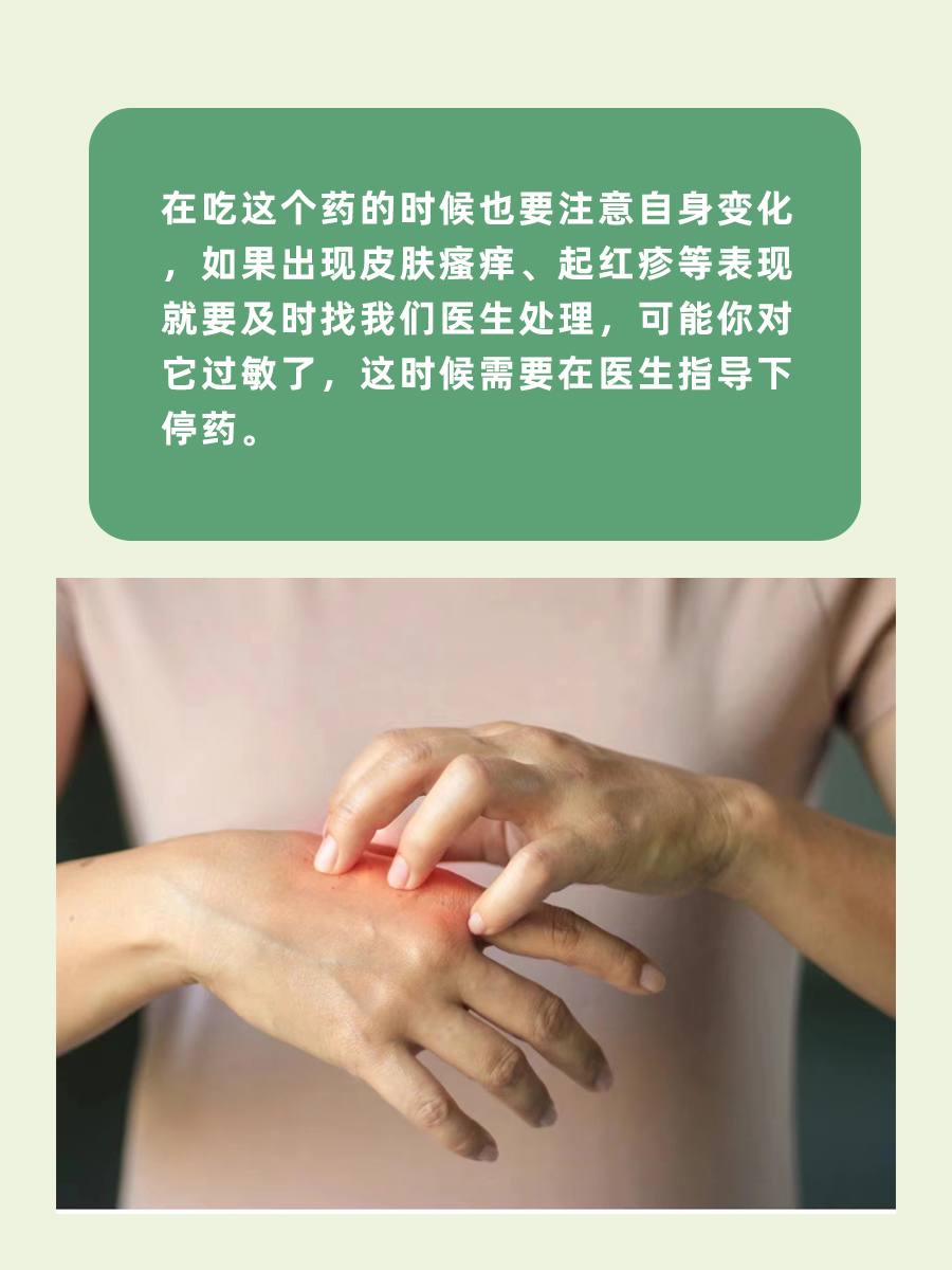 喝酒后不建议吃达泊西汀哦，用它还得注意这些