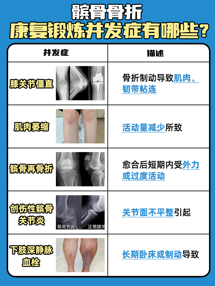 髌骨骨折后正确的康复锻炼方法,快看过来!