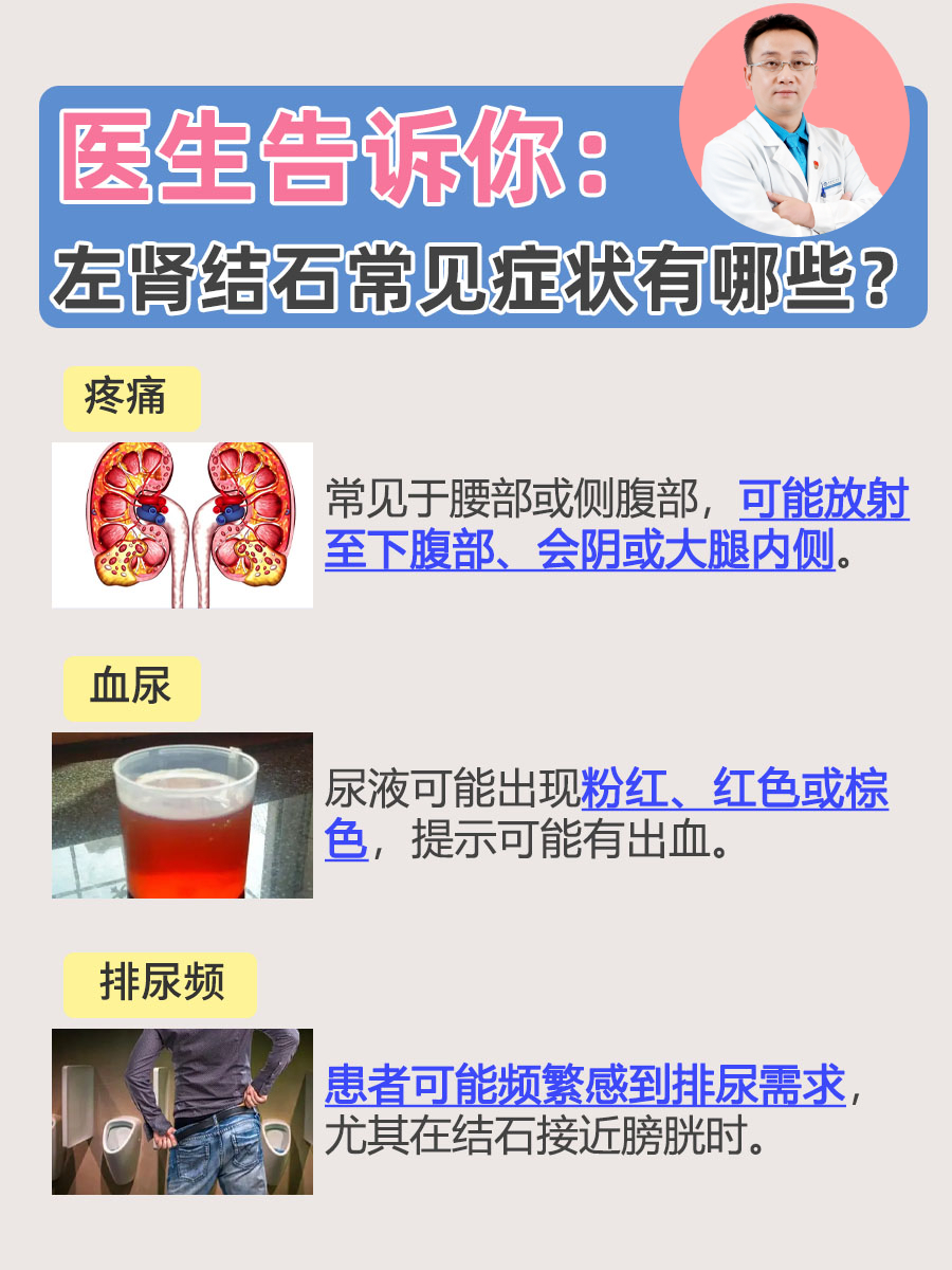 医生告诉你：左肾结石常见症状有哪些？