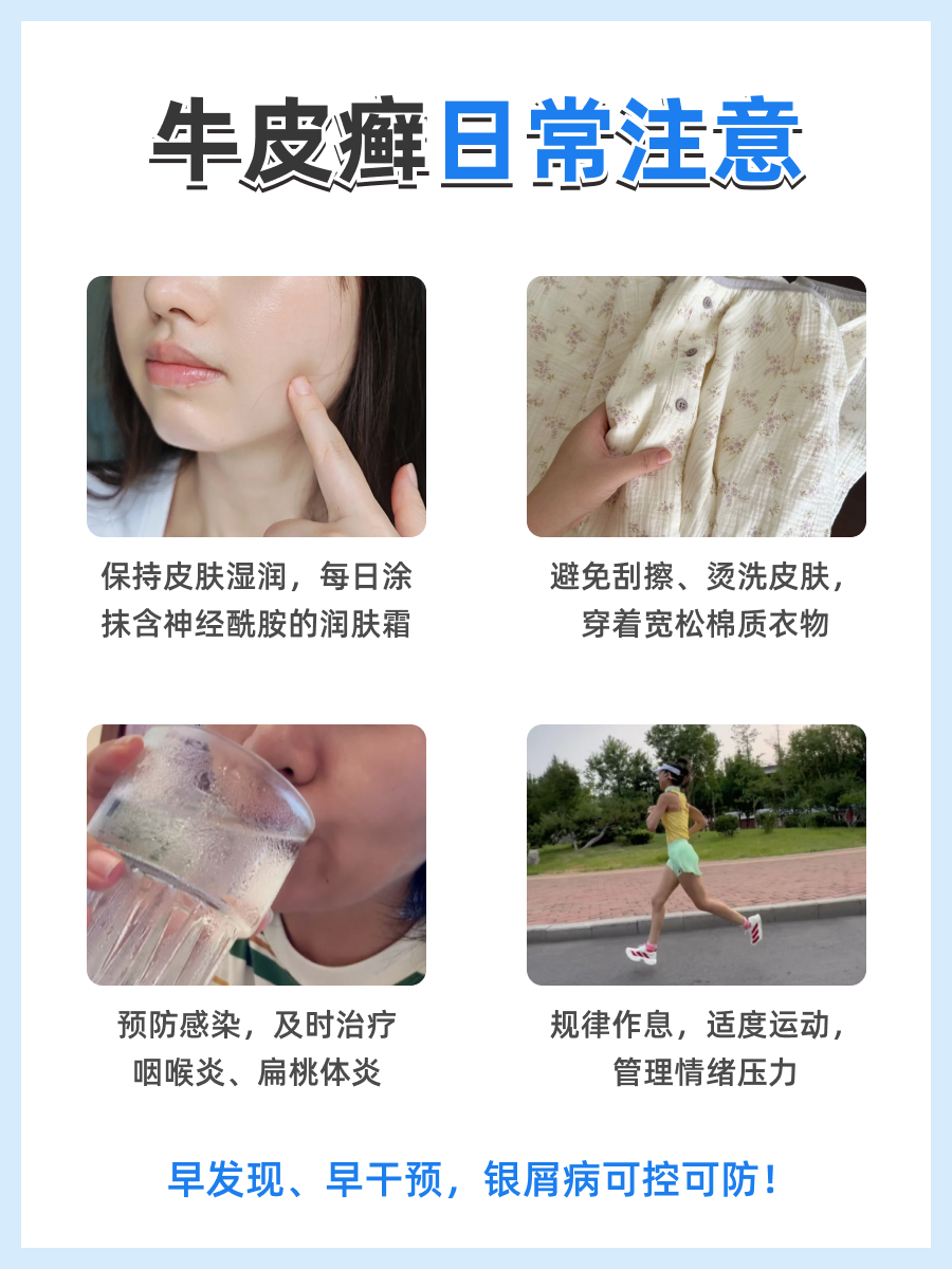 银屑病复发的10个征兆，早发现早控制！