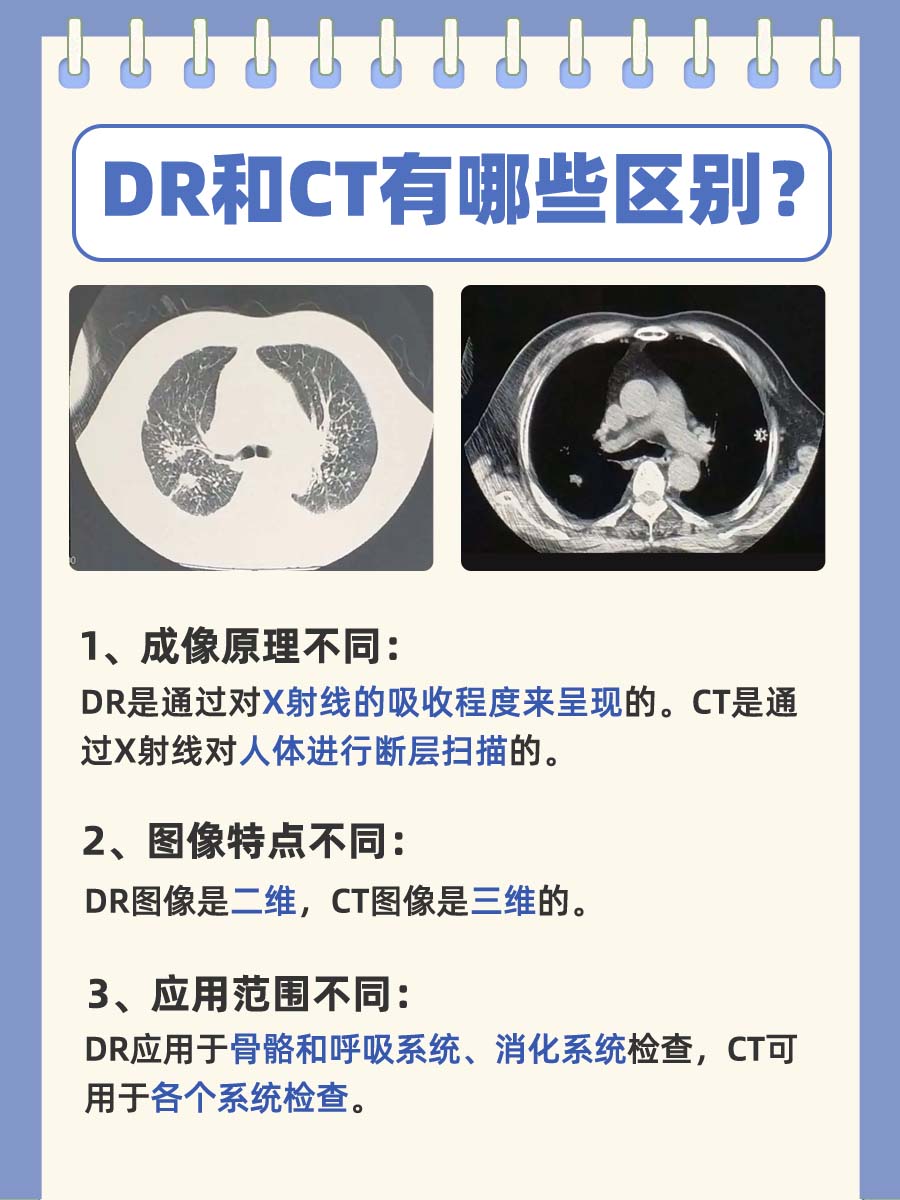 DR与CT大不同，你了解多少？