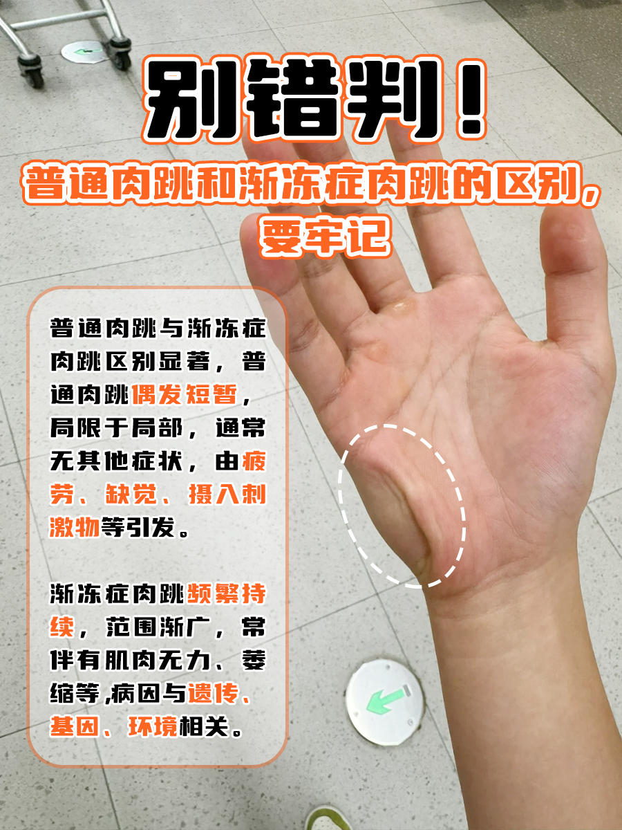 别错判！普通肉跳和渐冻症肉跳的区别，要牢记