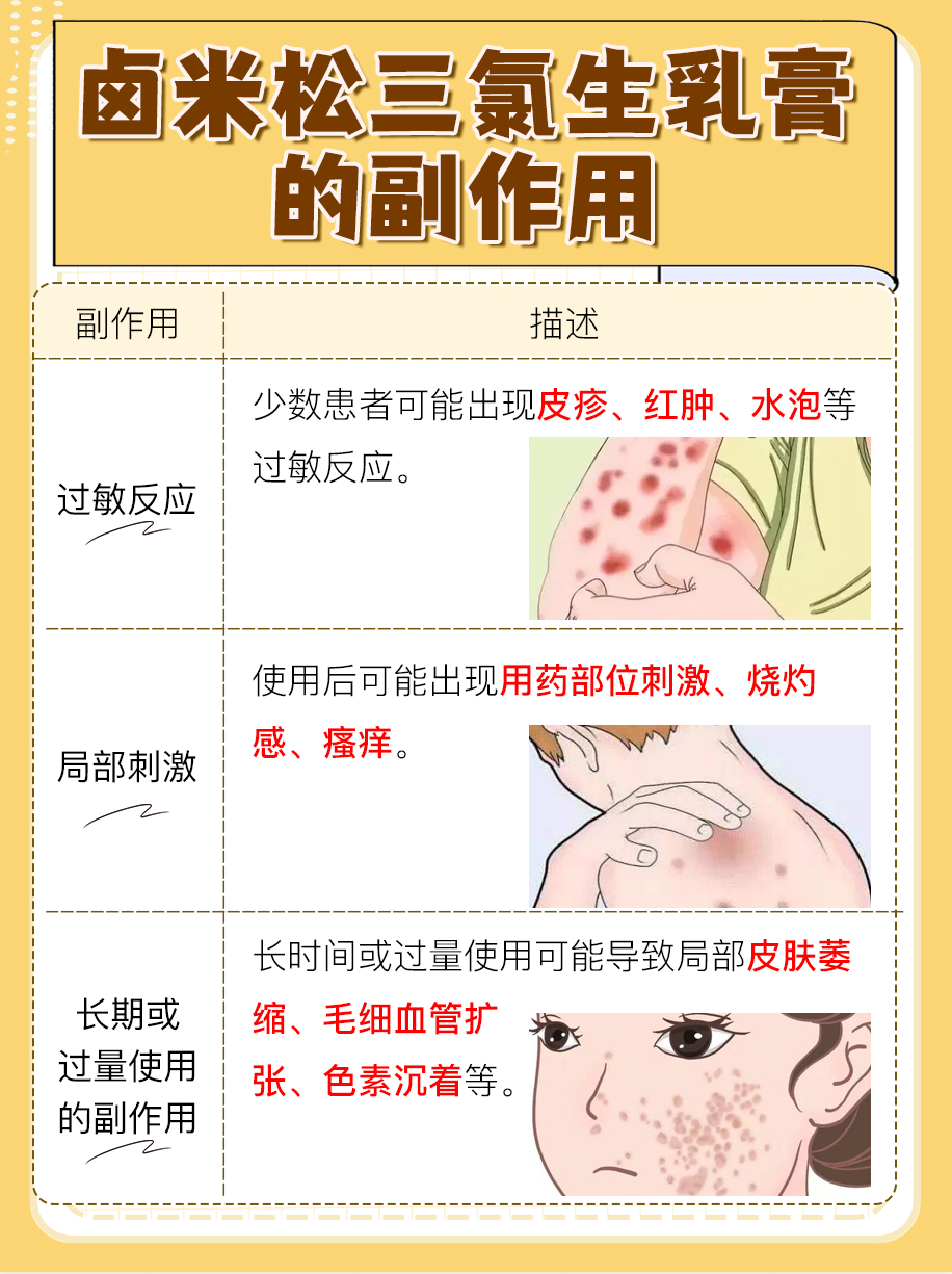 医生详解：卤米松三氯生乳膏的功效与作用