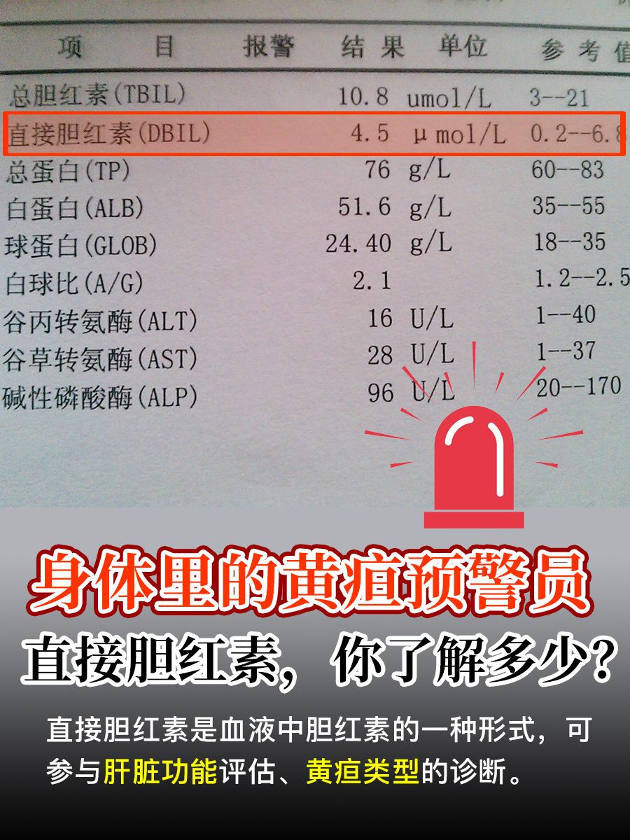 身体里的黄疸预警员：直接胆红素，你了解多少？