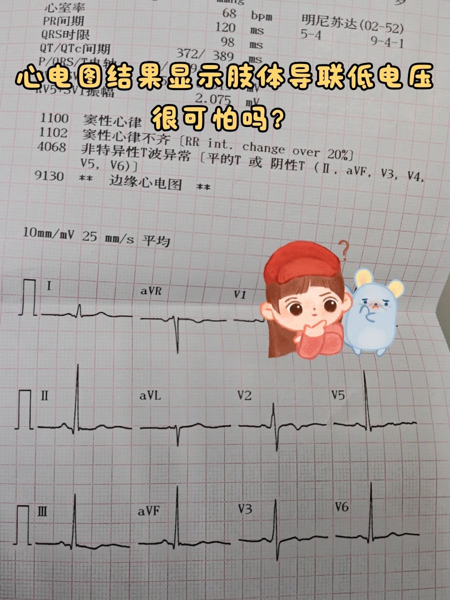 心电图结果显示肢体导联低电压,很可怕吗?