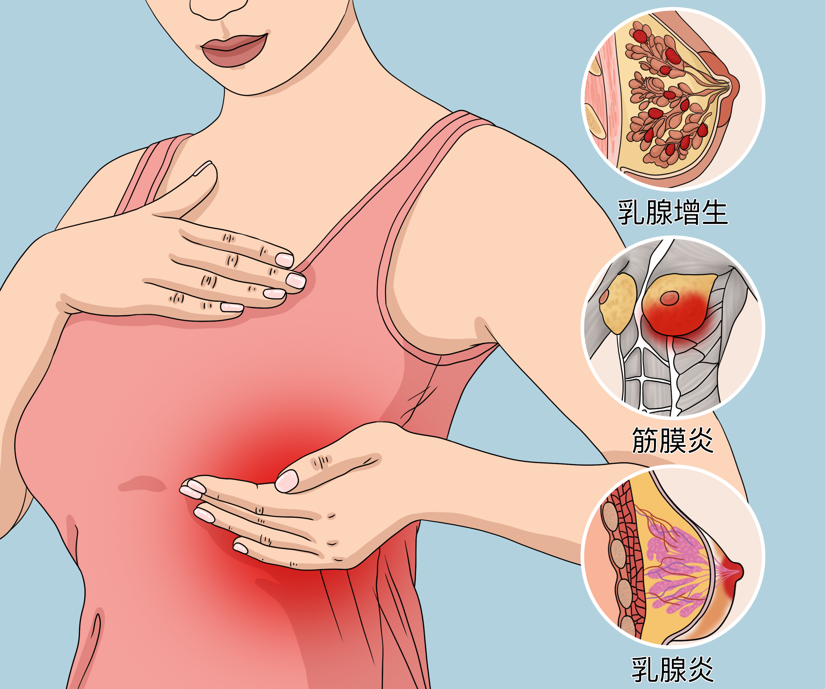 女性左侧乳房下侧疼痛图片