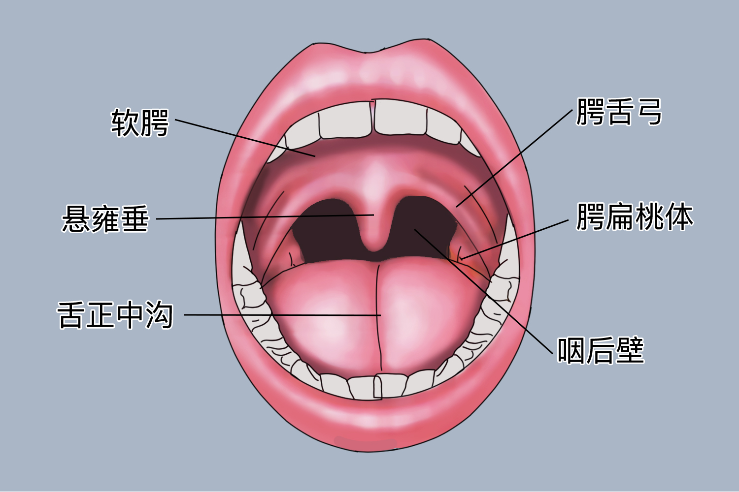咽部后壁示意图图片