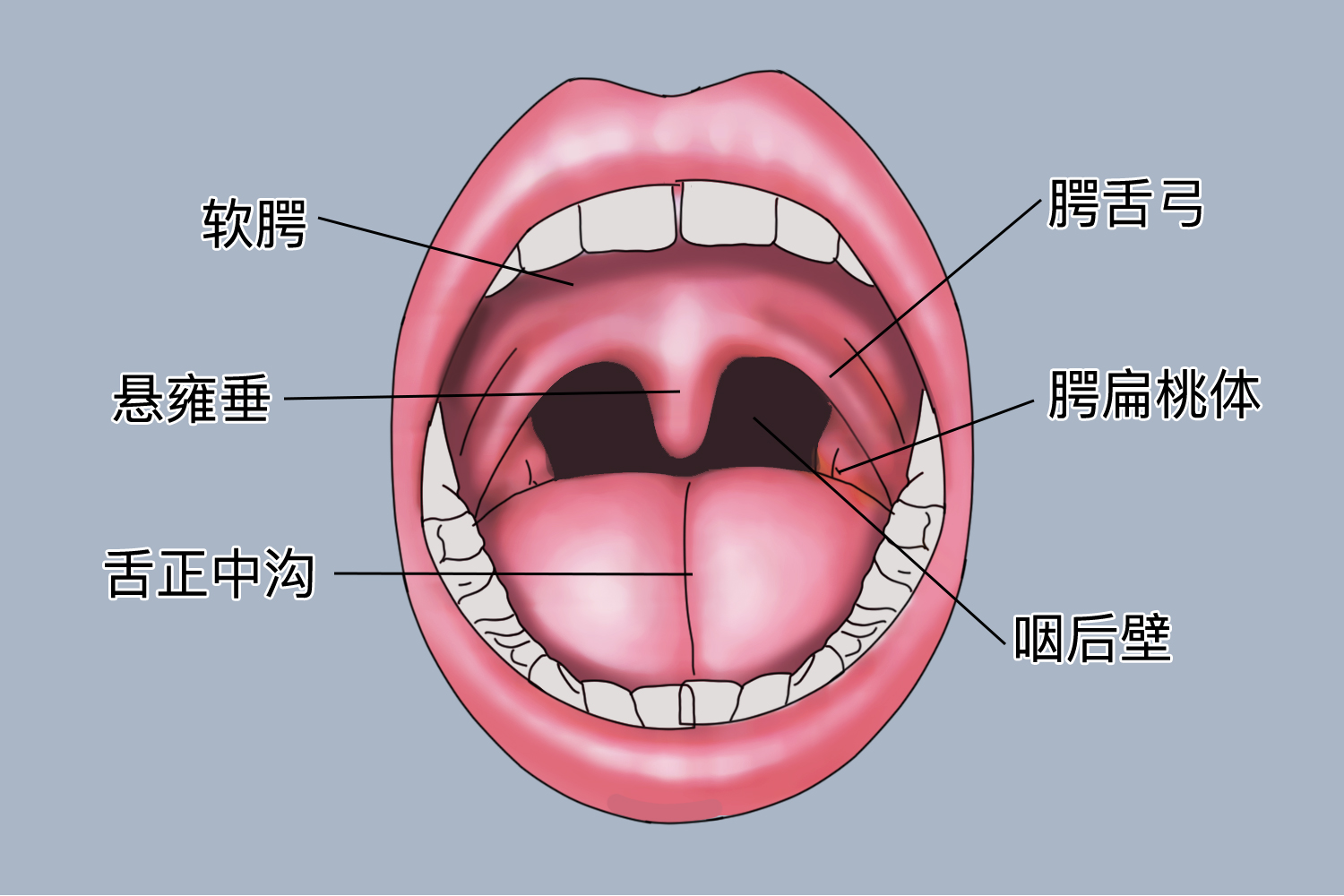 正常口腔扁桃体图片图片