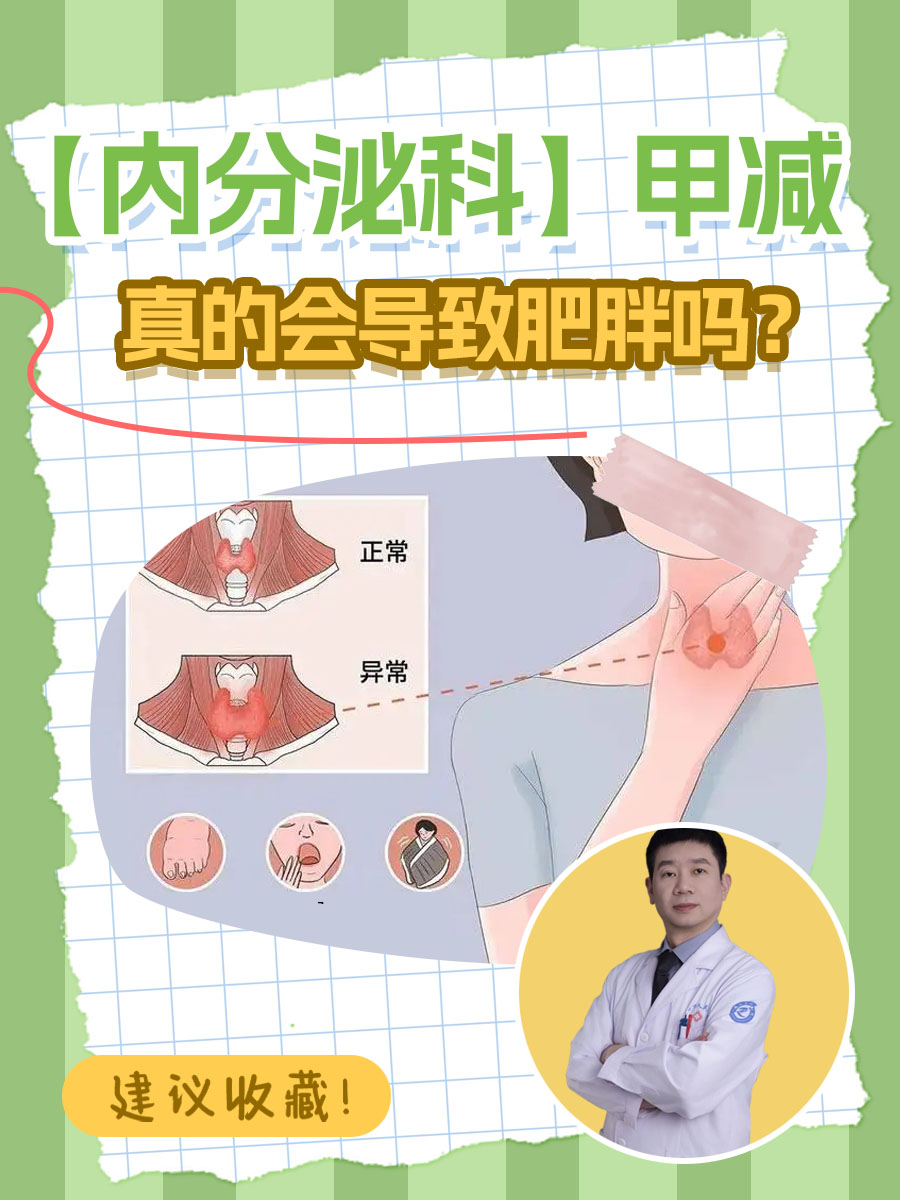 【内分泌科】甲减真的会导致肥胖吗？