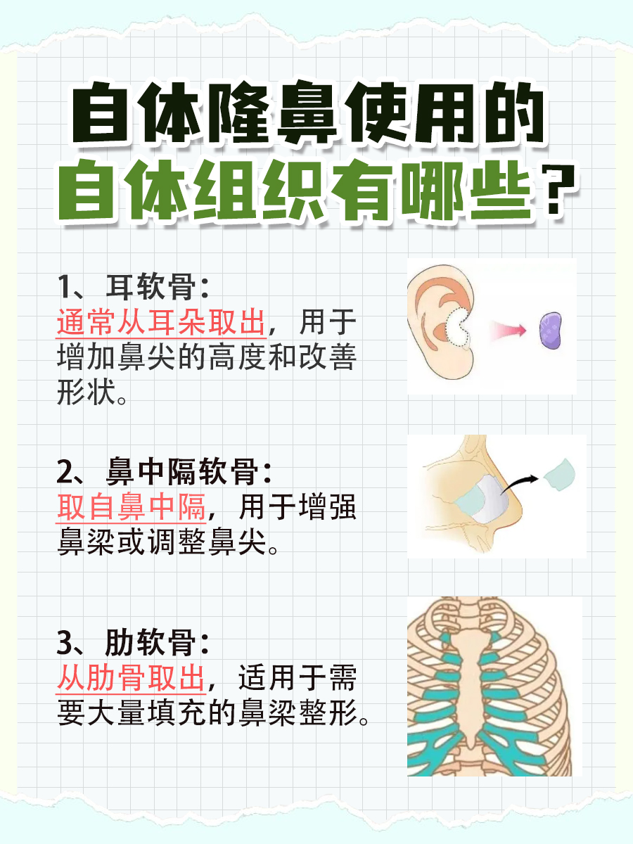 自体隆鼻有什么后遗症，一文了解！