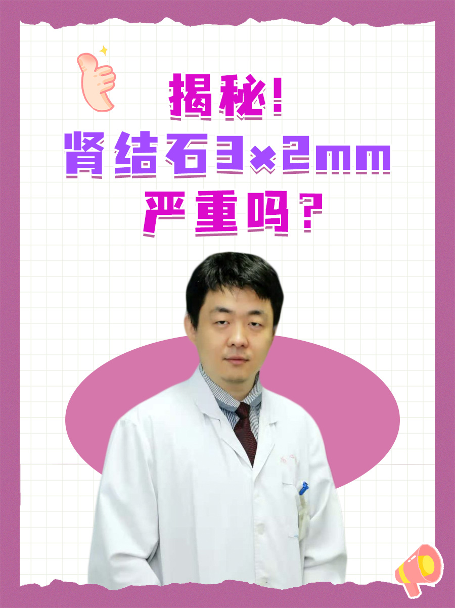 揭秘！肾结石3x2mm严重吗？