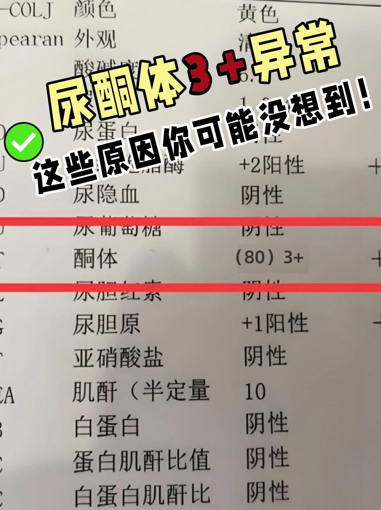 尿酮体3+异常，这些原因你可能没想到！