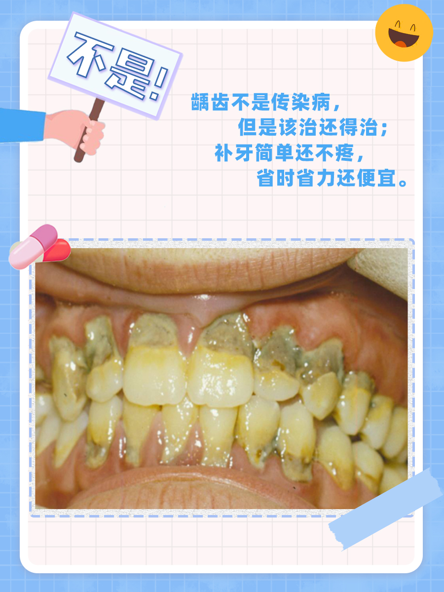 生物教科书中说龋齿是传染病？是真的吗？