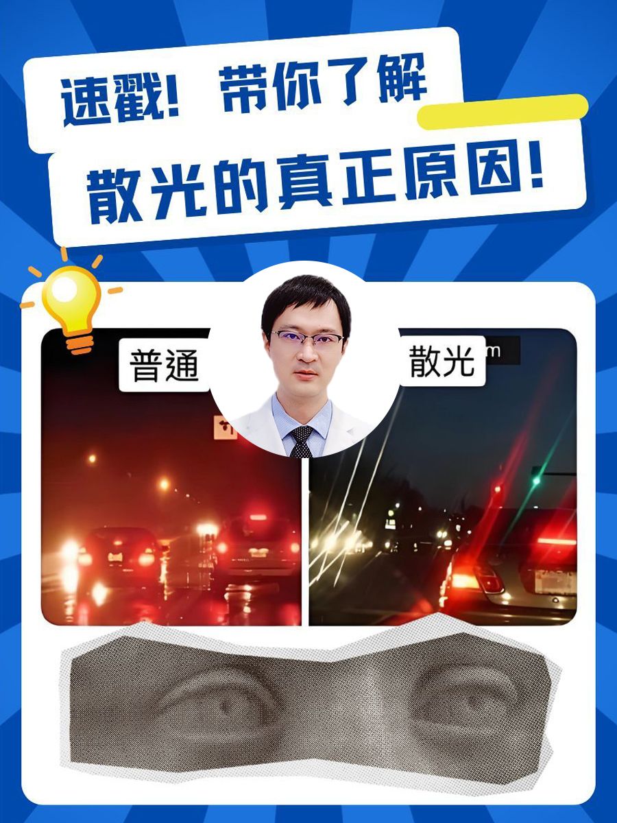 速戳！带你了解散光的真正原因！
