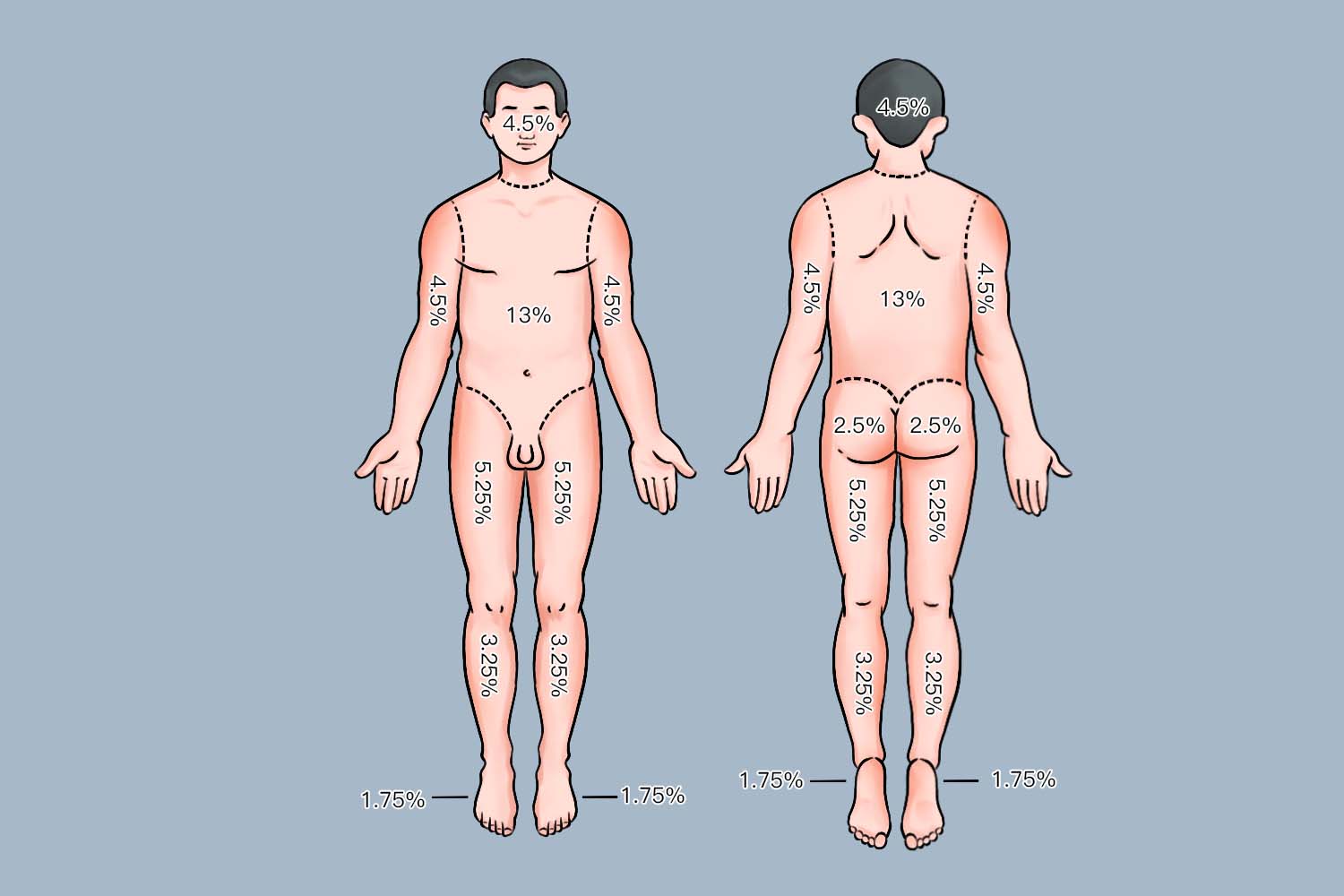 烧伤面积估算中国九分法图