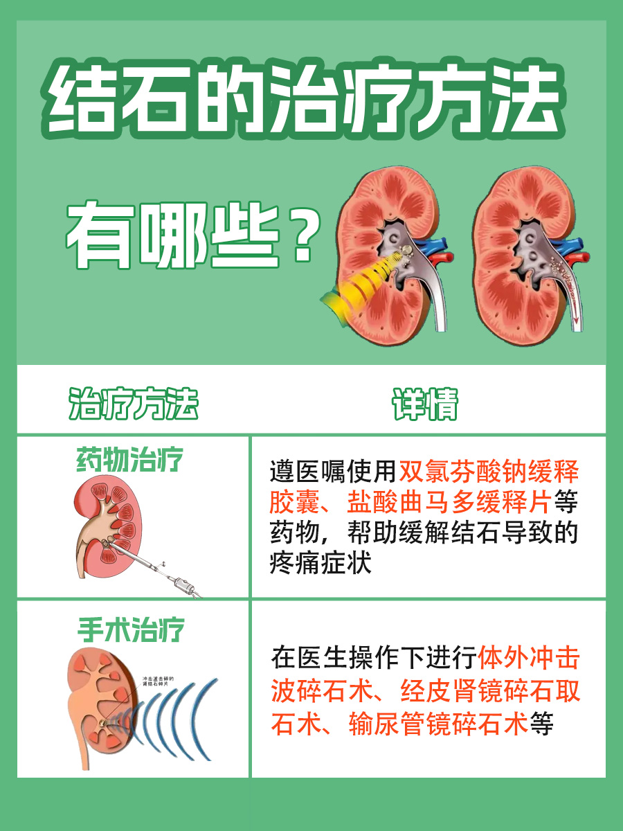 带你了解，结石多大需要做碎石手术