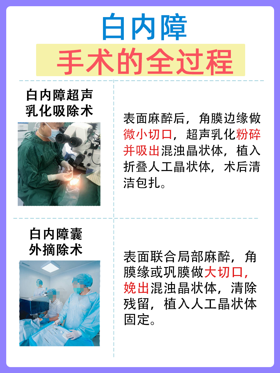 了解一下：白内障手术全过程
