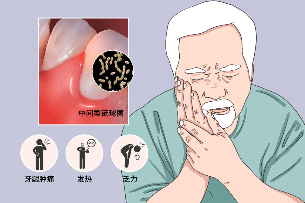 犊牛链球菌症状图片图片