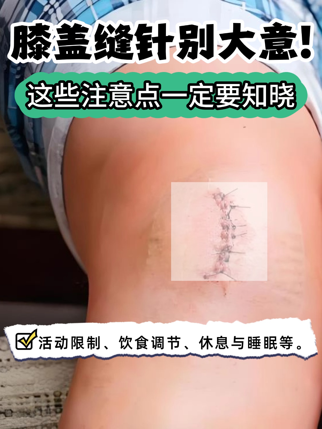 膝盖缝针别大意！这些注意点一定要知晓