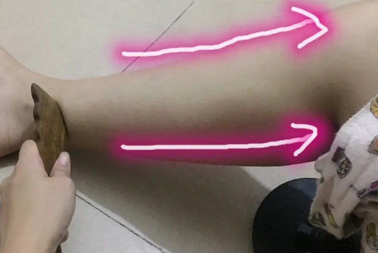 腿部刮痧图